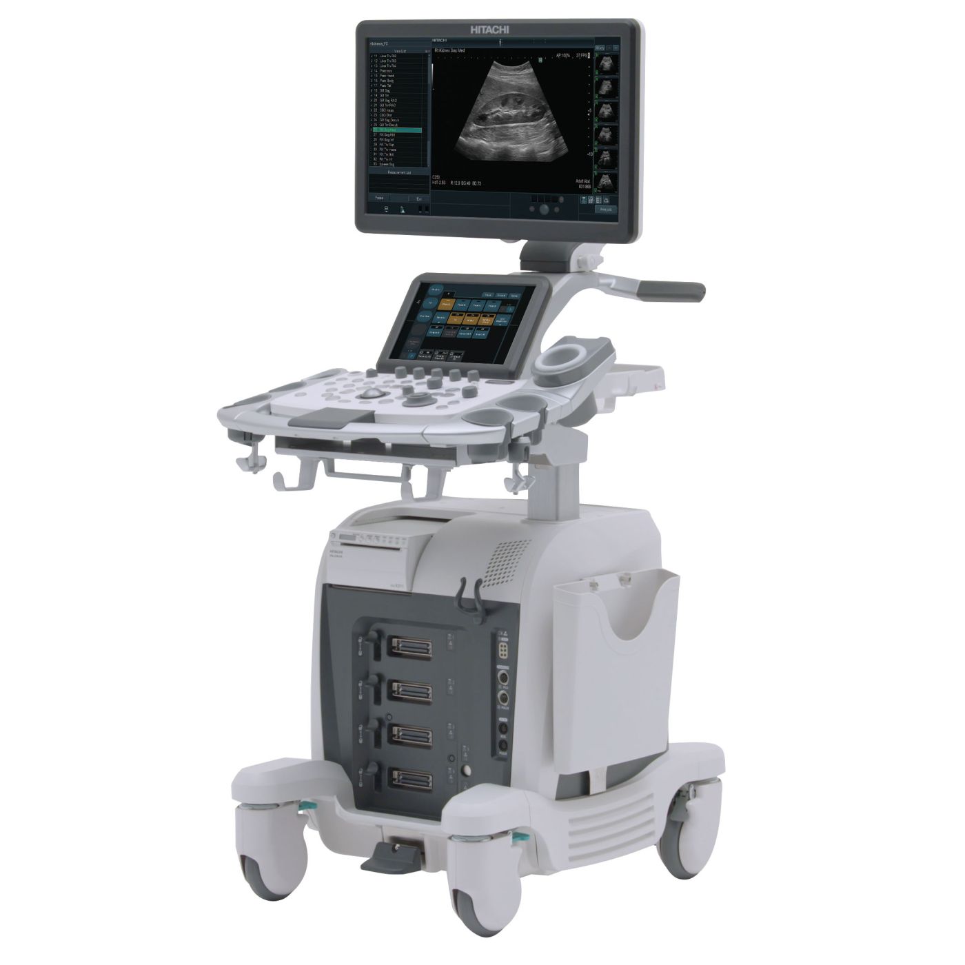 УЗИ аппарат Hitachi Arietta 65