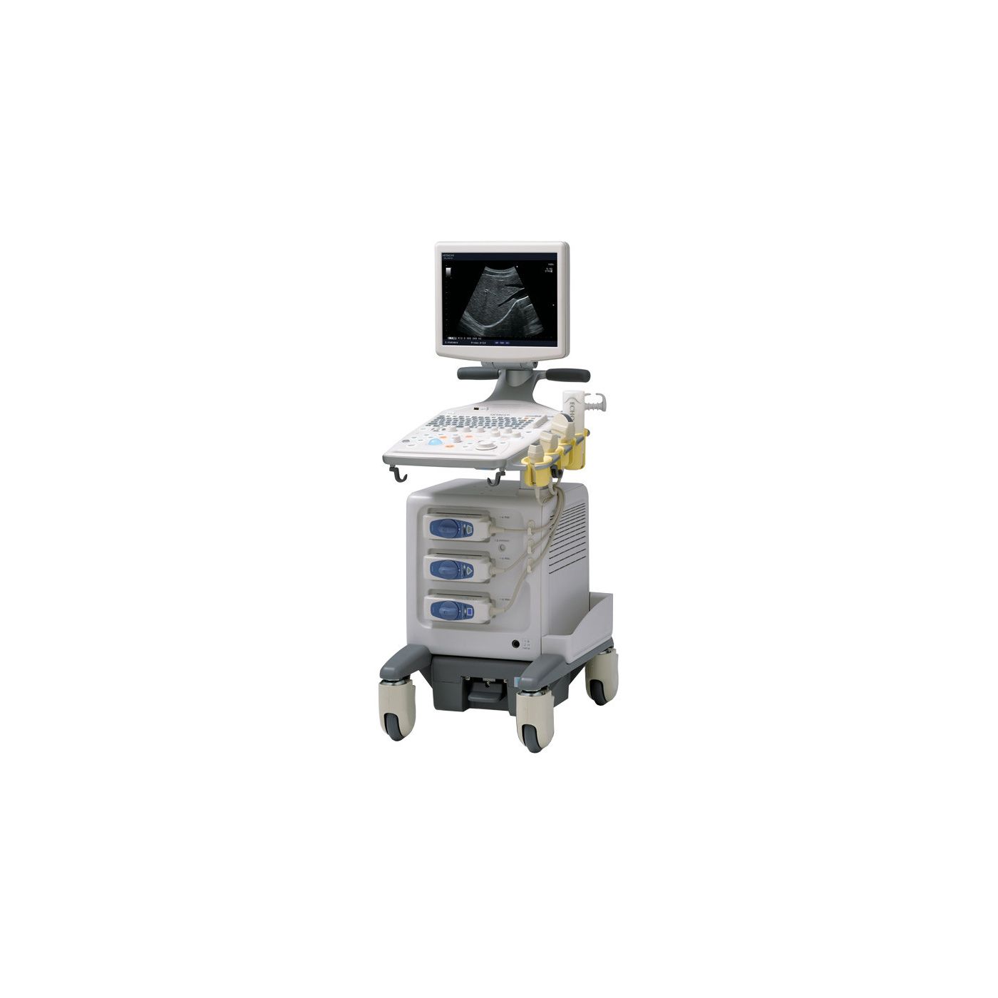 УЗИ аппарат Hitachi Aloka ProSound F31