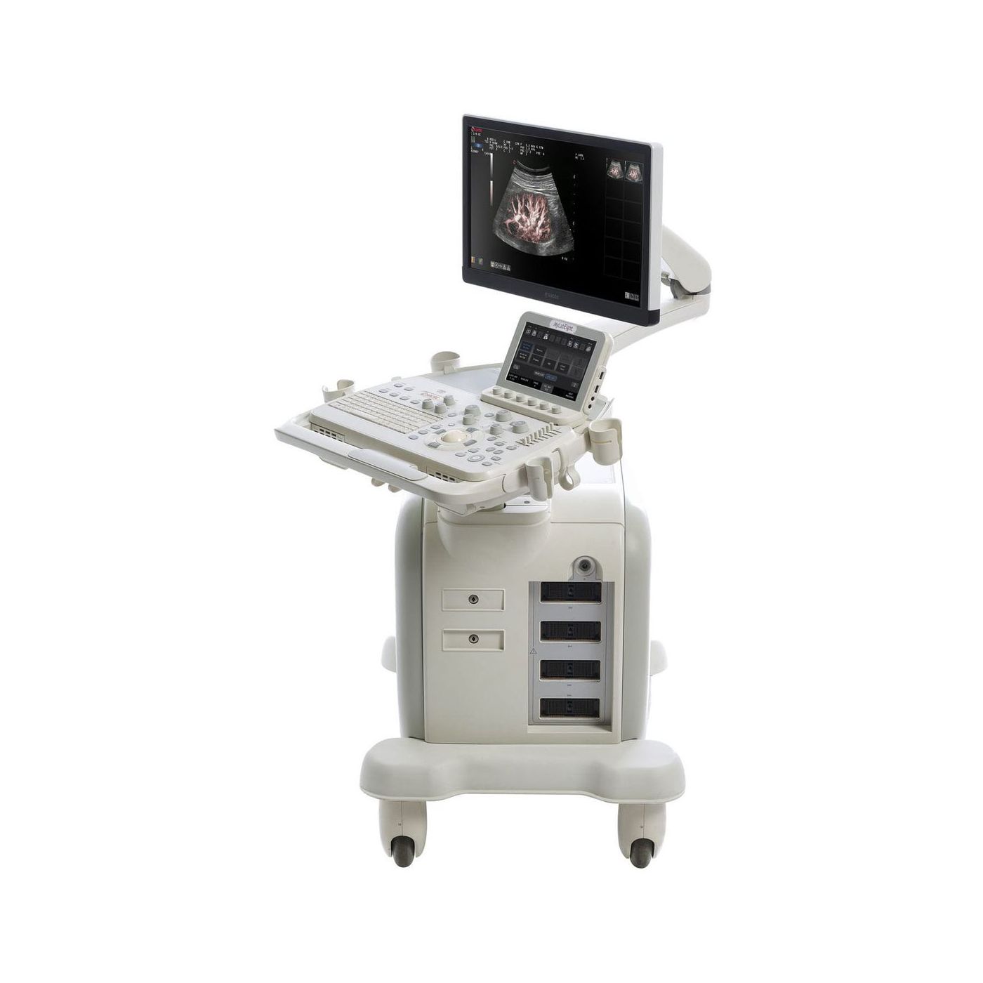 УЗИ аппарат Esaote MyLab Eight