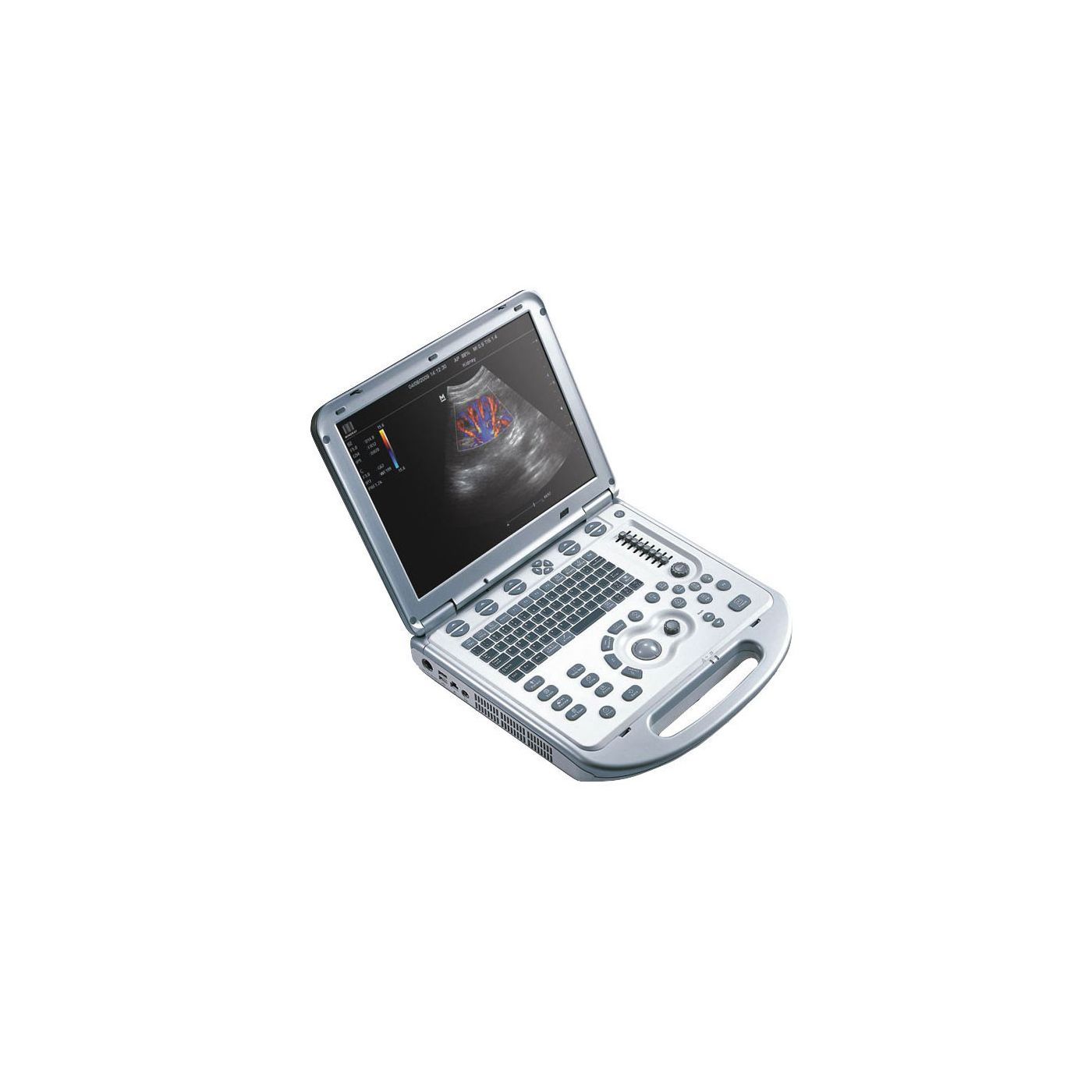 УЗИ аппарат Mindray M7 Premium