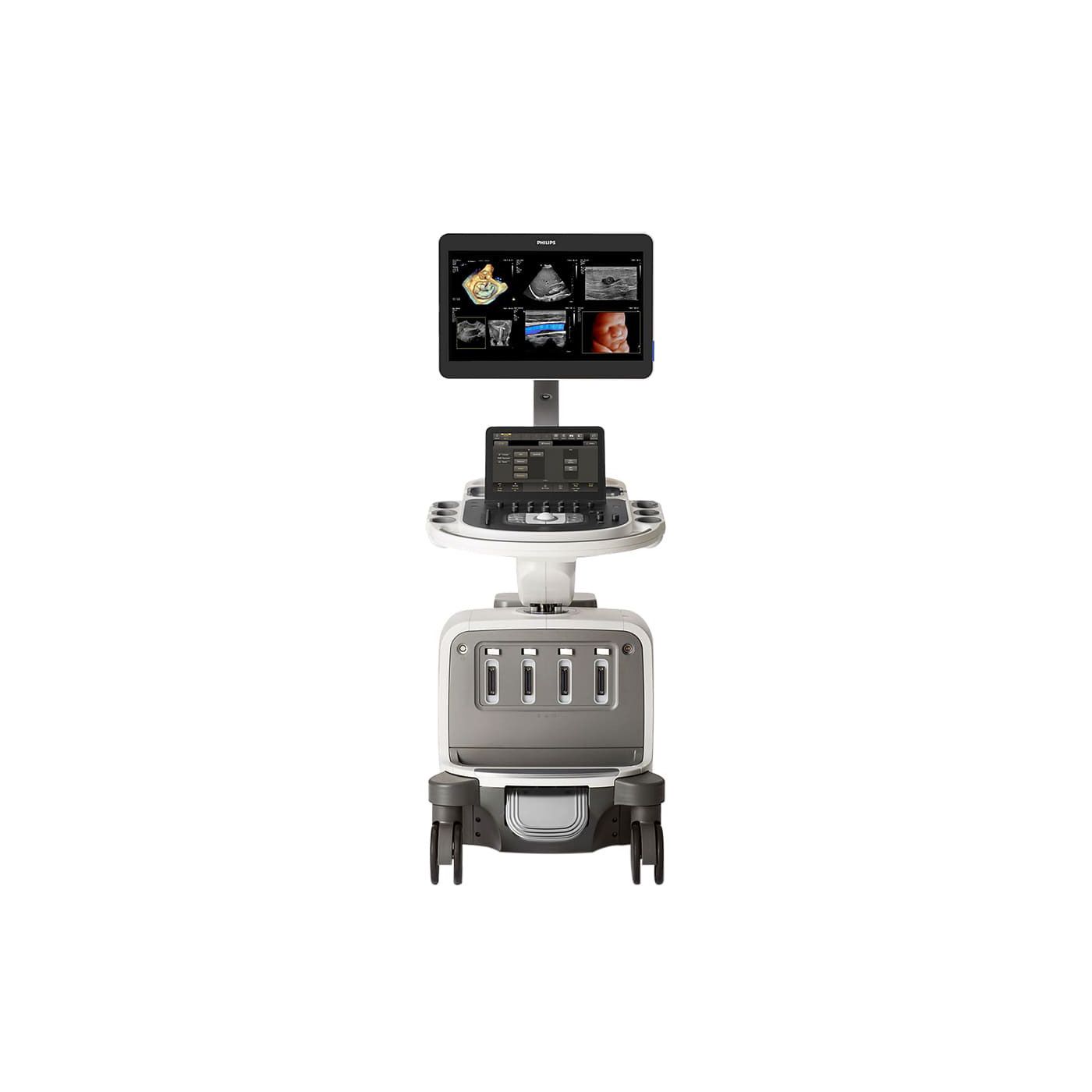 УЗИ аппарат Philips EPIQ Elite