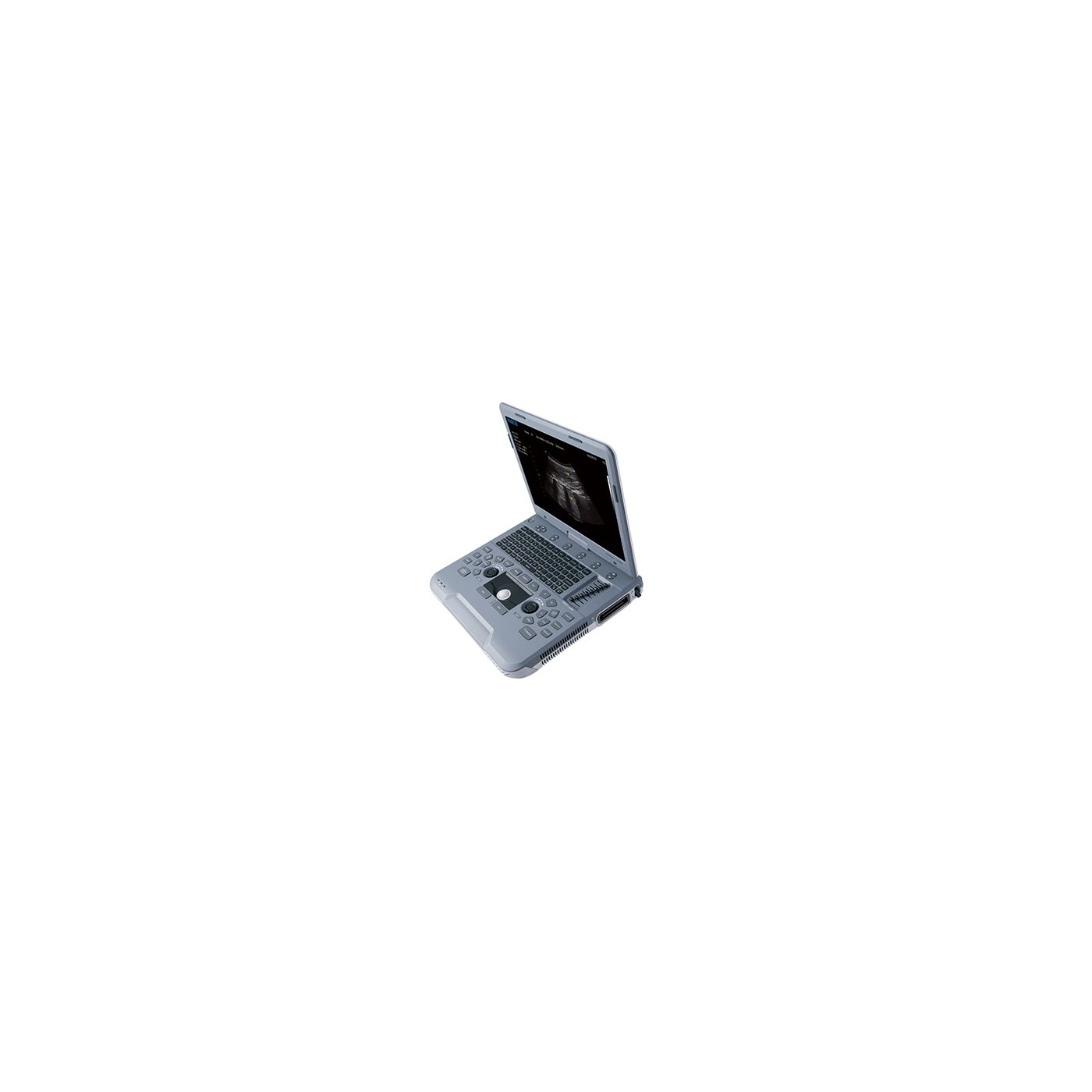 УЗИ аппарат SIUI Apogee 1000 Neo