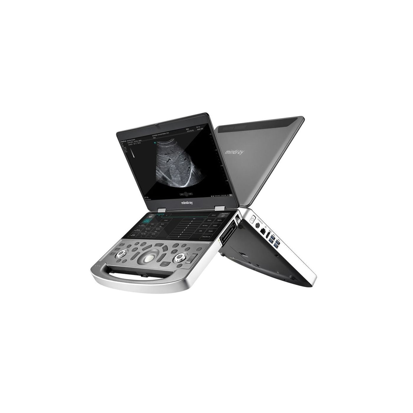 Портативный УЗИ аппарат Mindray MX8 Exp
