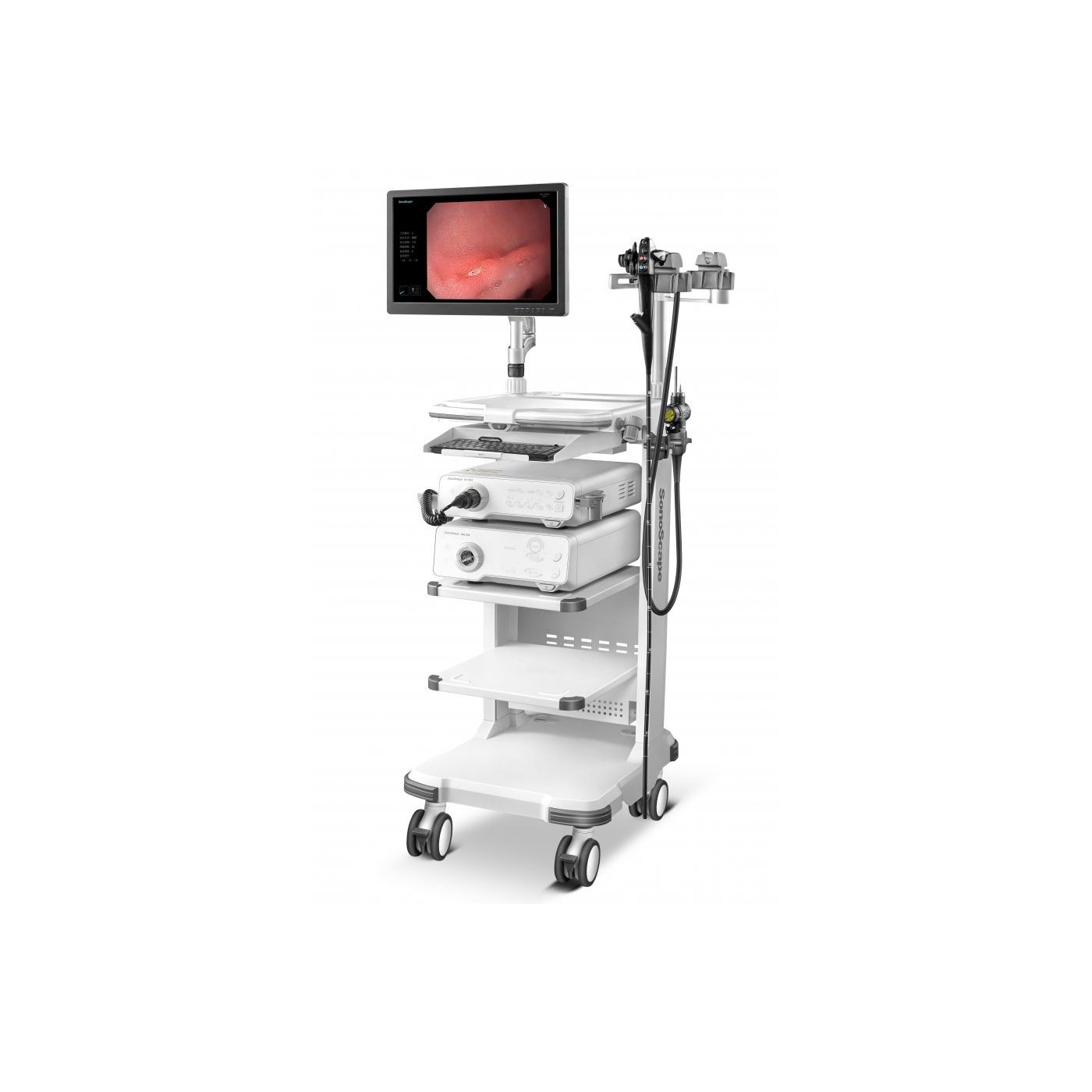 Видеоэндоскопическая система на базе SonoScape HD-350 (HD)
