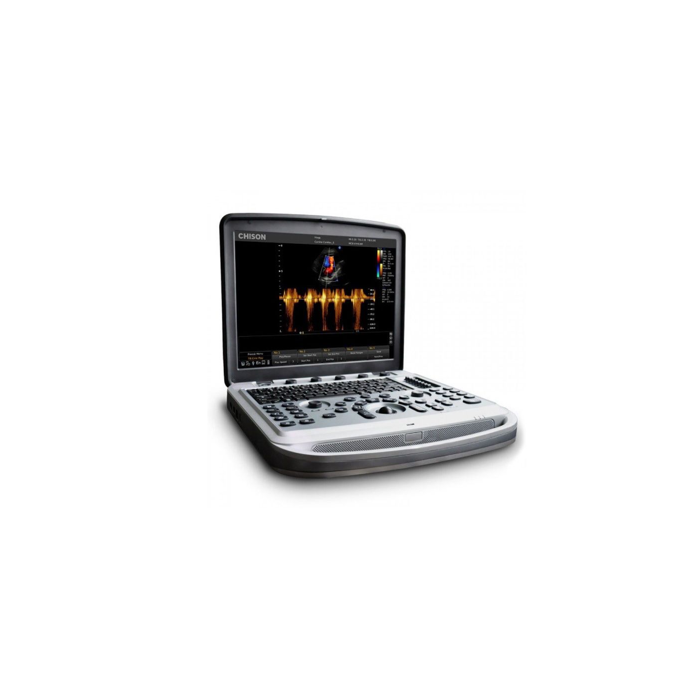 УЗИ аппарат Chison Sonotouch 80 (SonoBook 6)