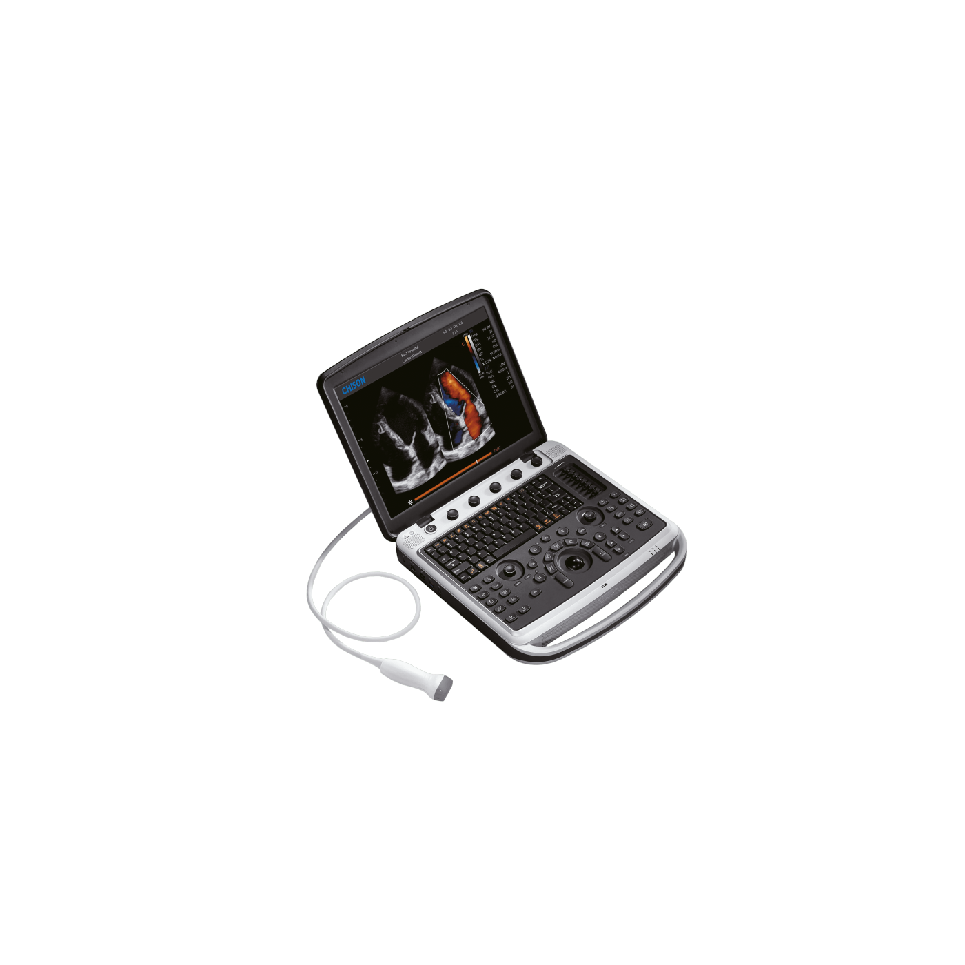 УЗИ аппарат Chison Sonotouch 80 (SonoBook 8)