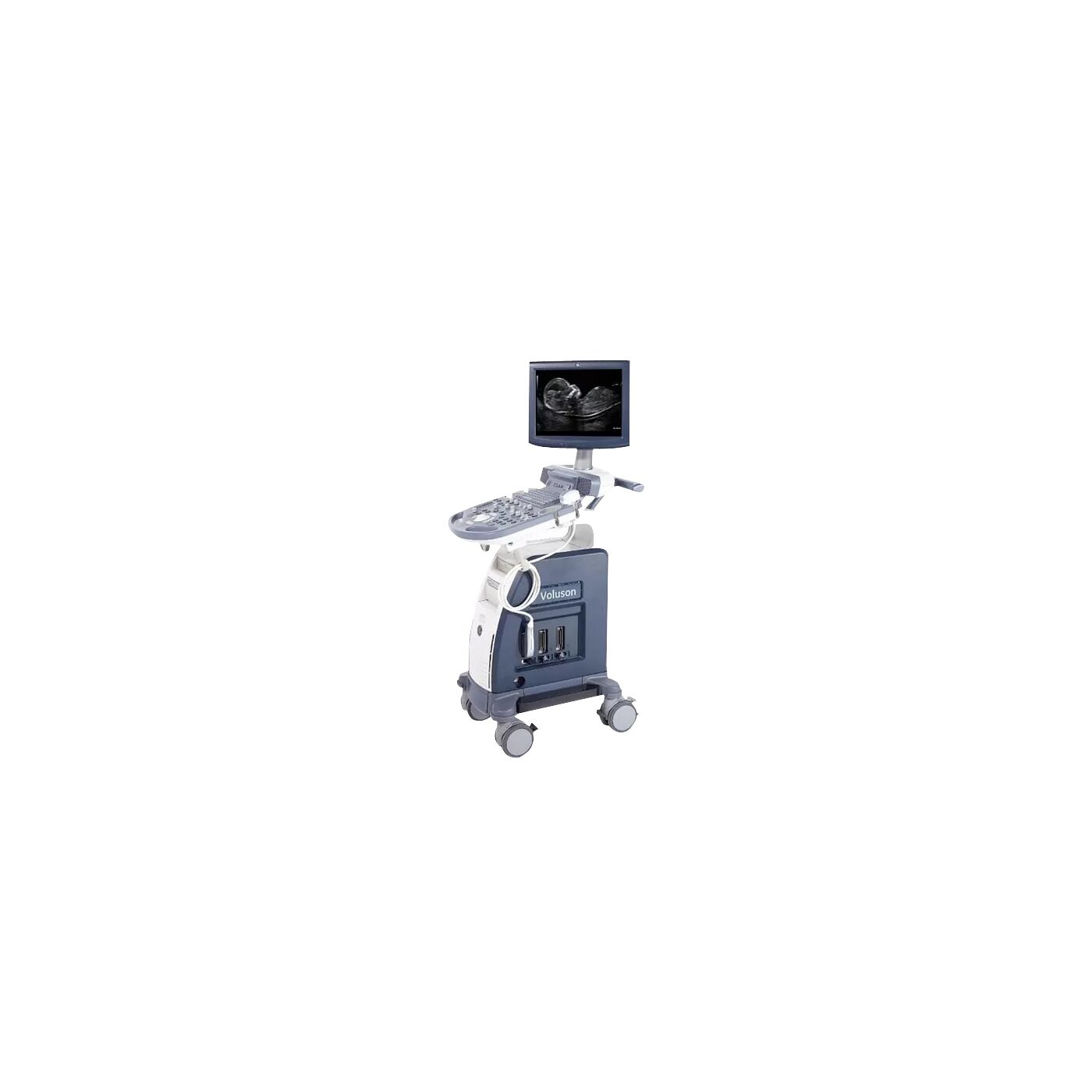 УЗИ аппарат GE Healthcare Voluson P8