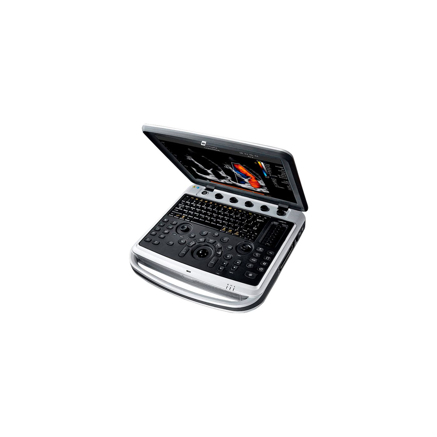 УЗИ аппарат CHISON SonoBook 9