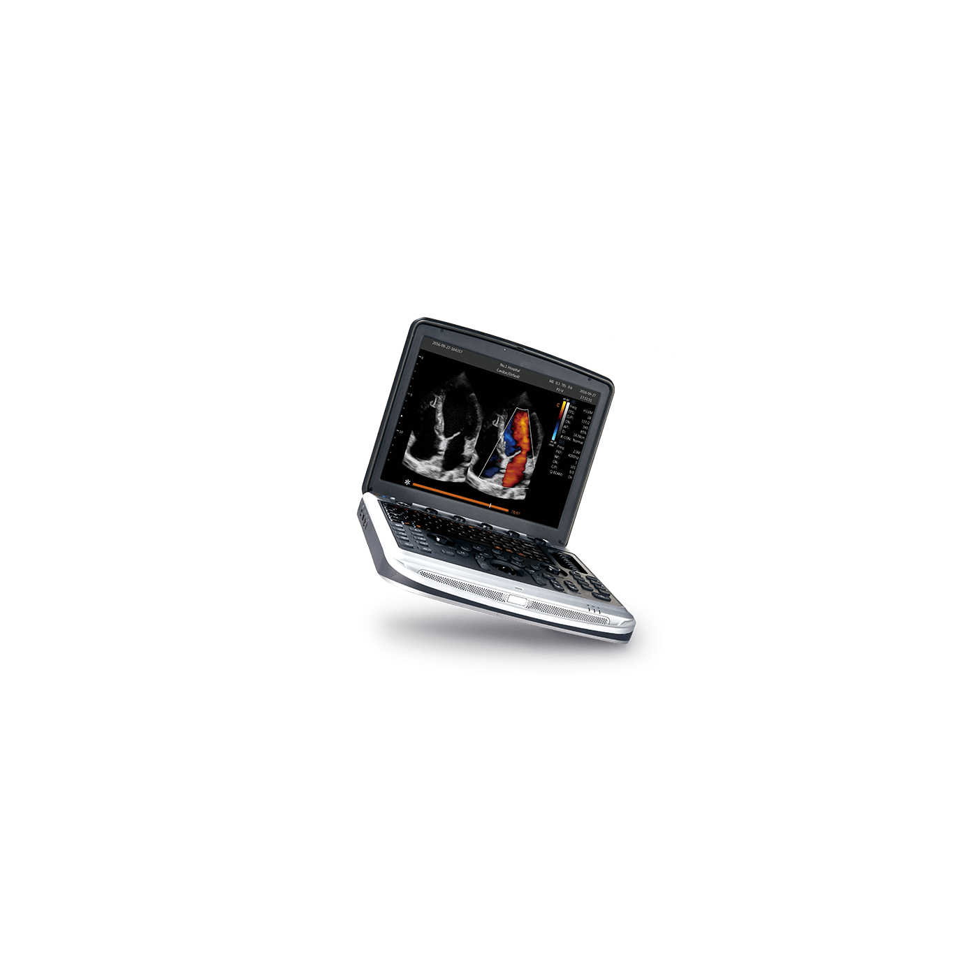 УЗИ аппарат Chison Sonotouch 80 (SonoBook 8)