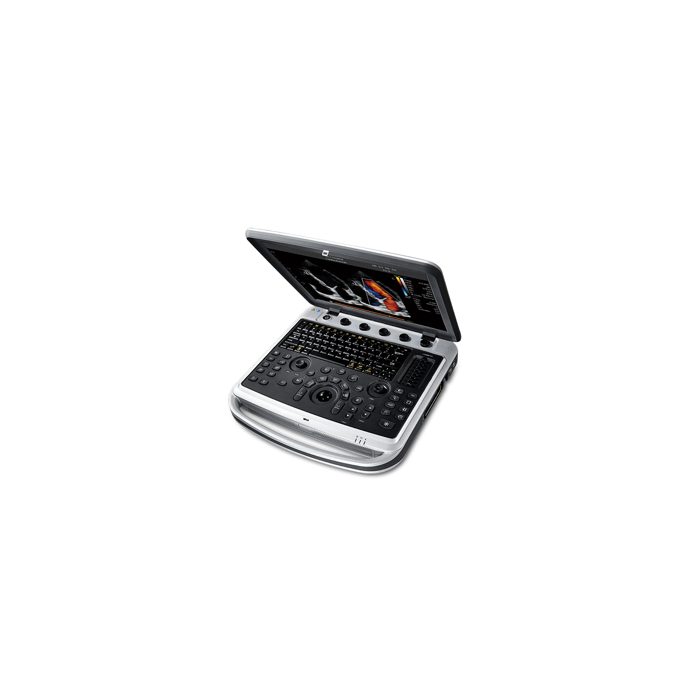 УЗИ аппарат Chison Sonotouch 80 (SonoBook 8)