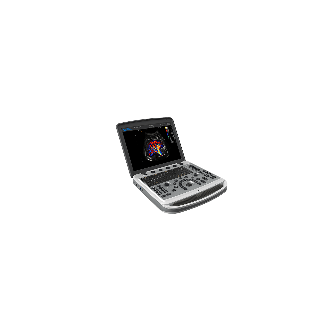 УЗИ аппарат Chison Sonotouch 80 (SonoBook 6)