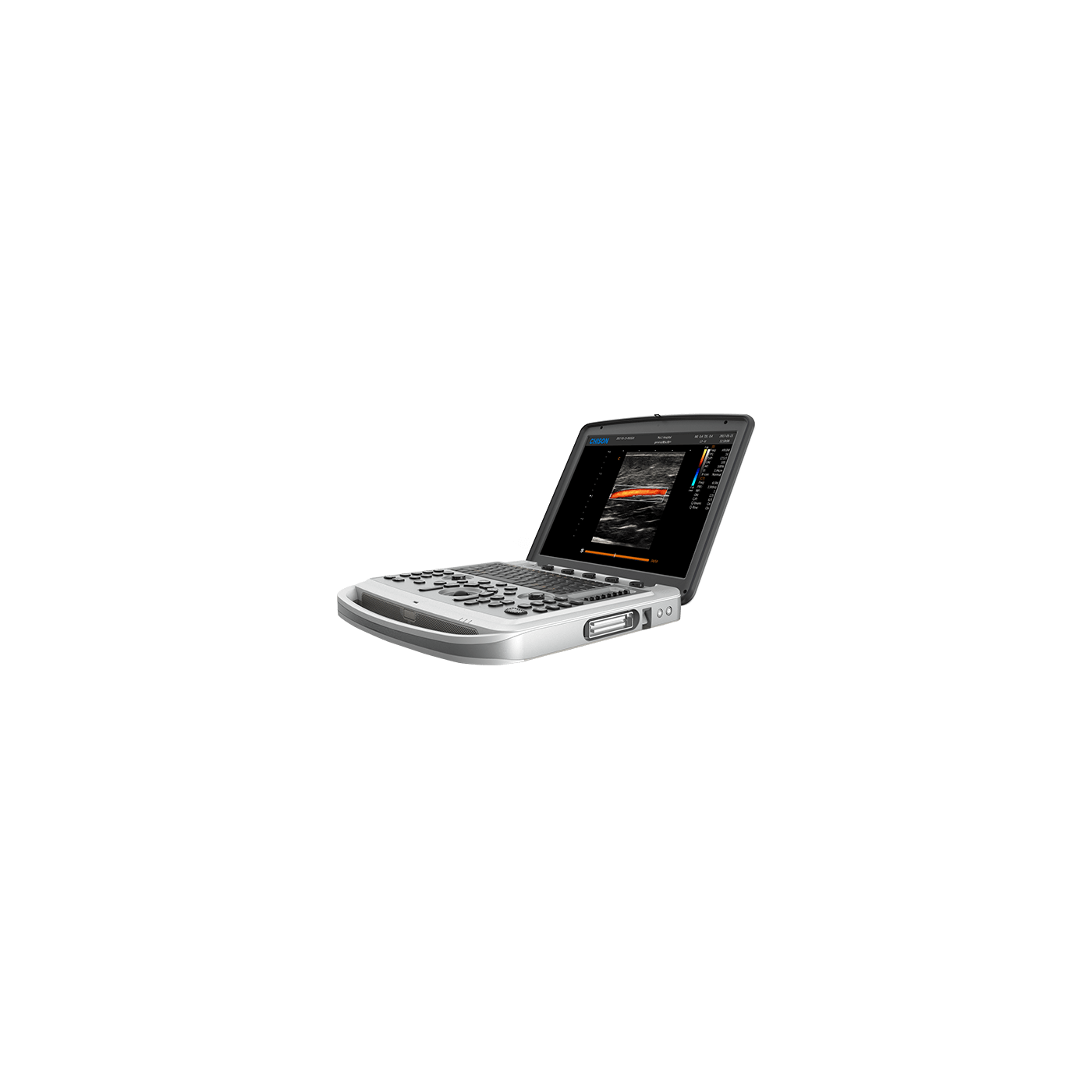УЗИ аппарат Chison Sonotouch 80 (SonoBook 6)