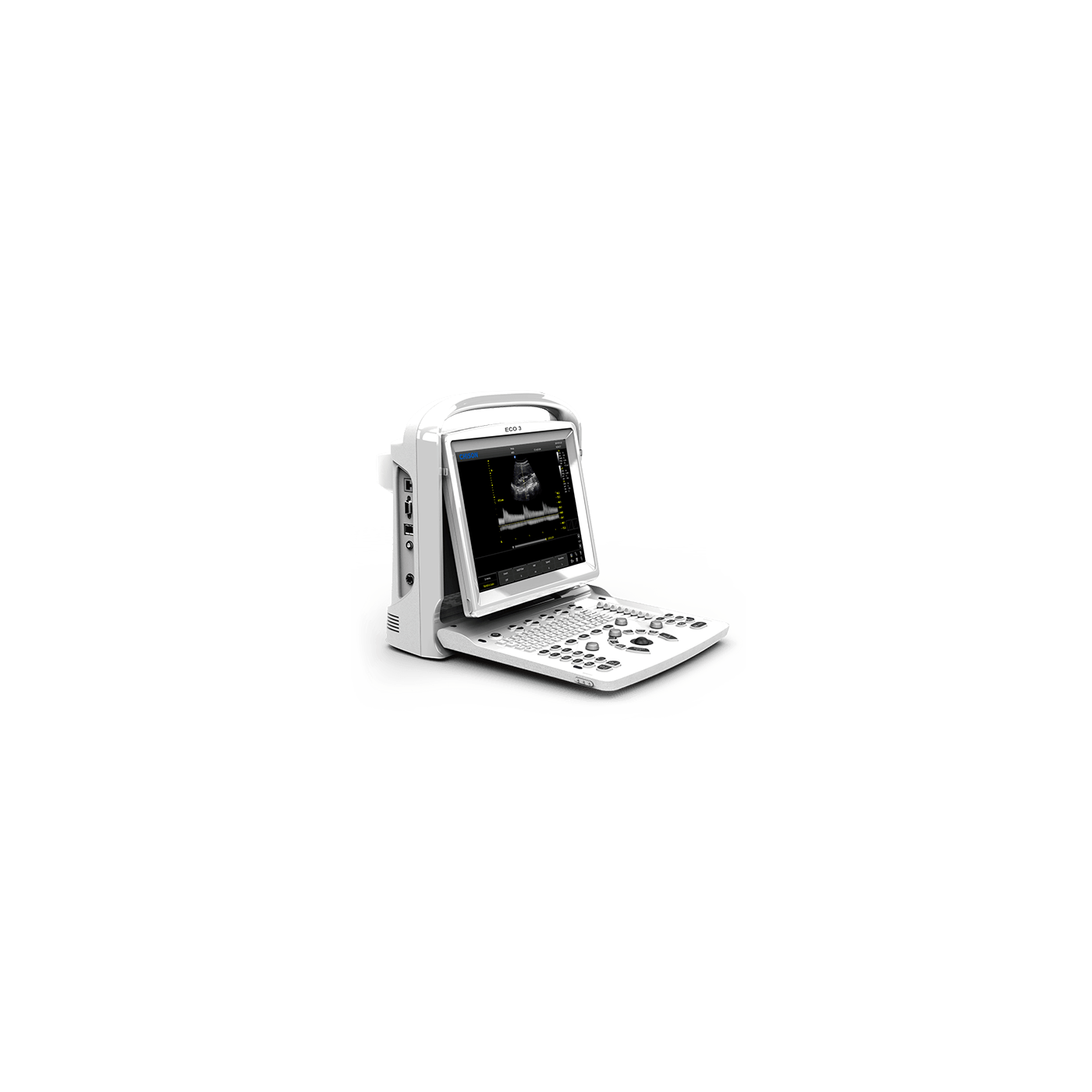 УЗИ аппарат CHISON ECO 3 Expert