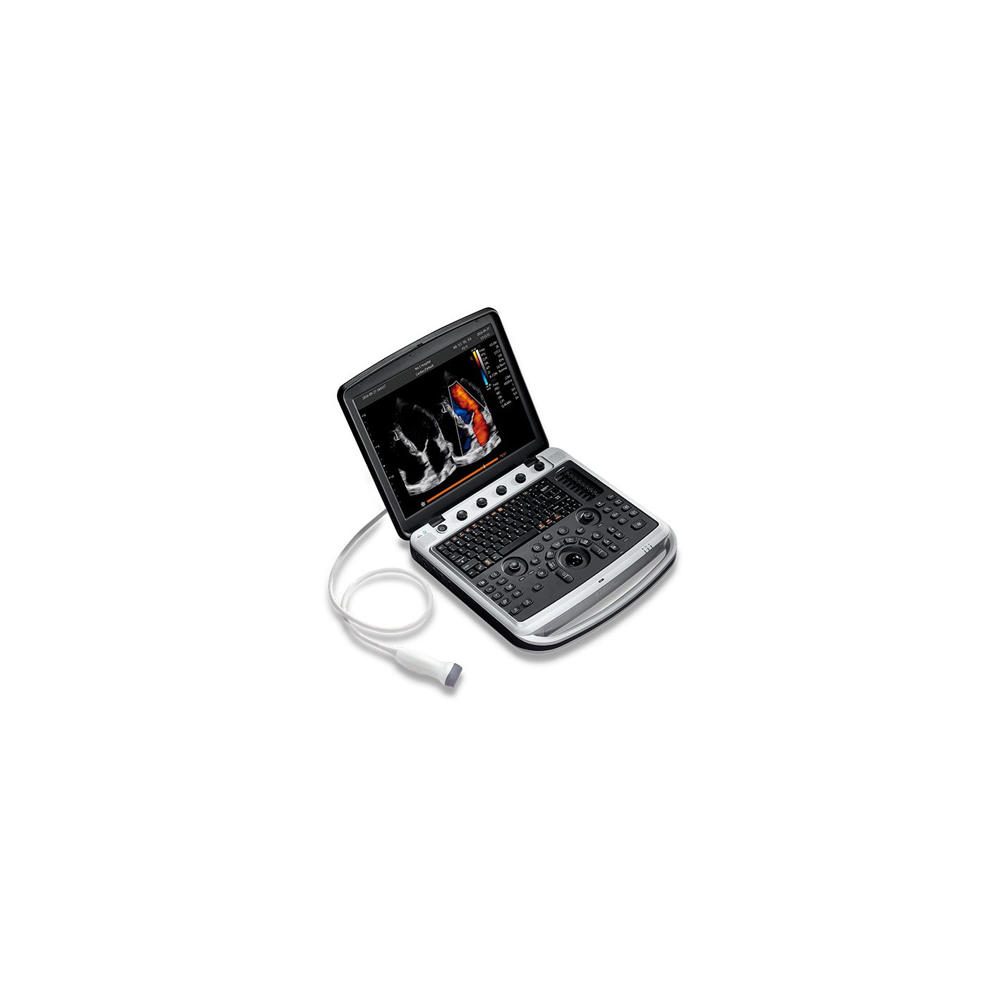 УЗИ аппарат CHISON SonoBook 9