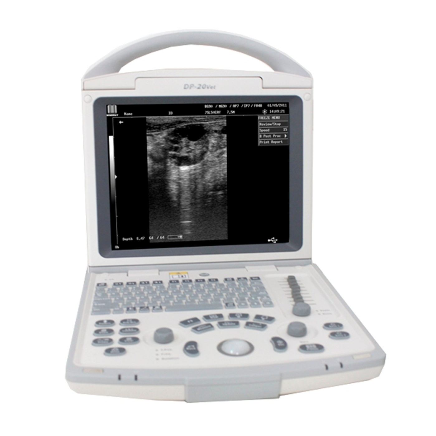 УЗ система Mindray DP-20
