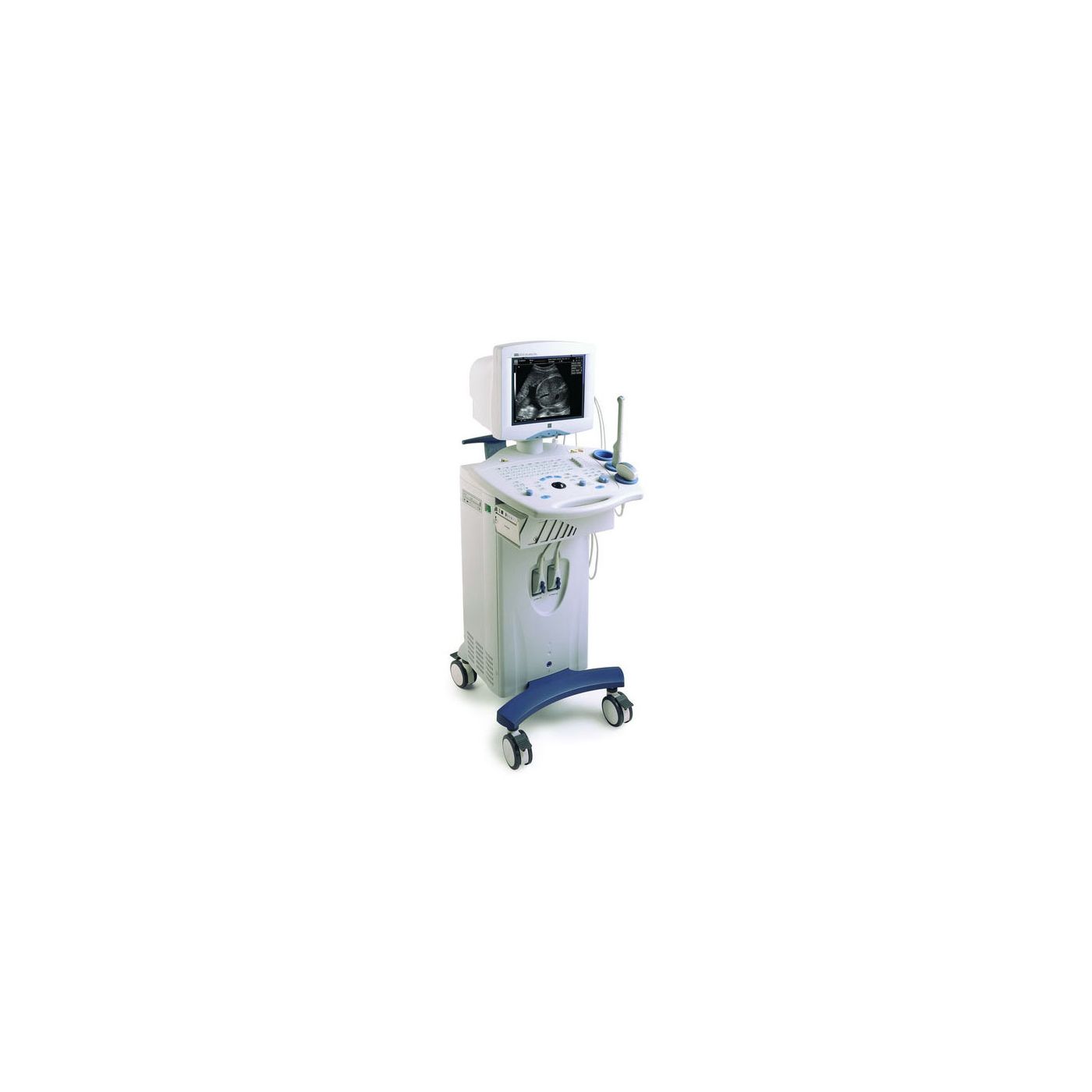 УЗИ аппарат Mindray DP 8800