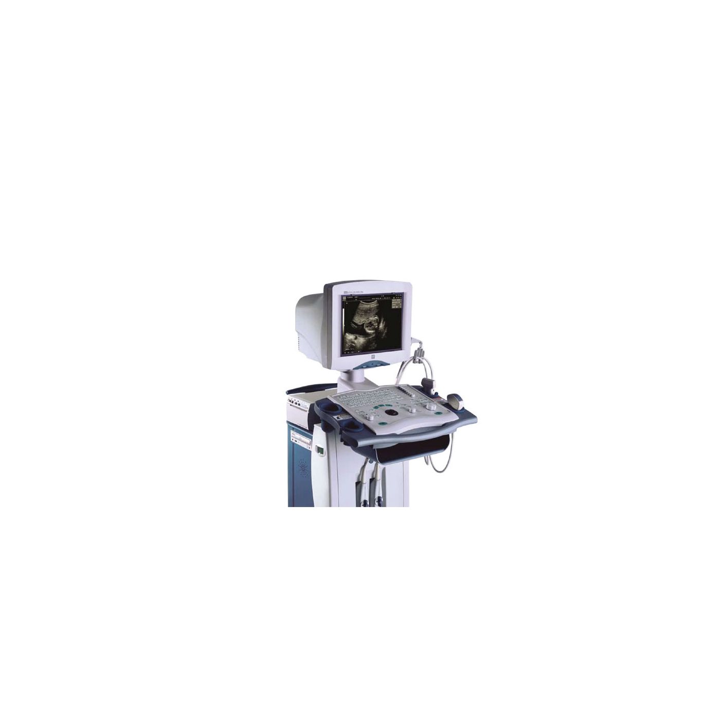 УЗИ аппарат Mindray DP 9900