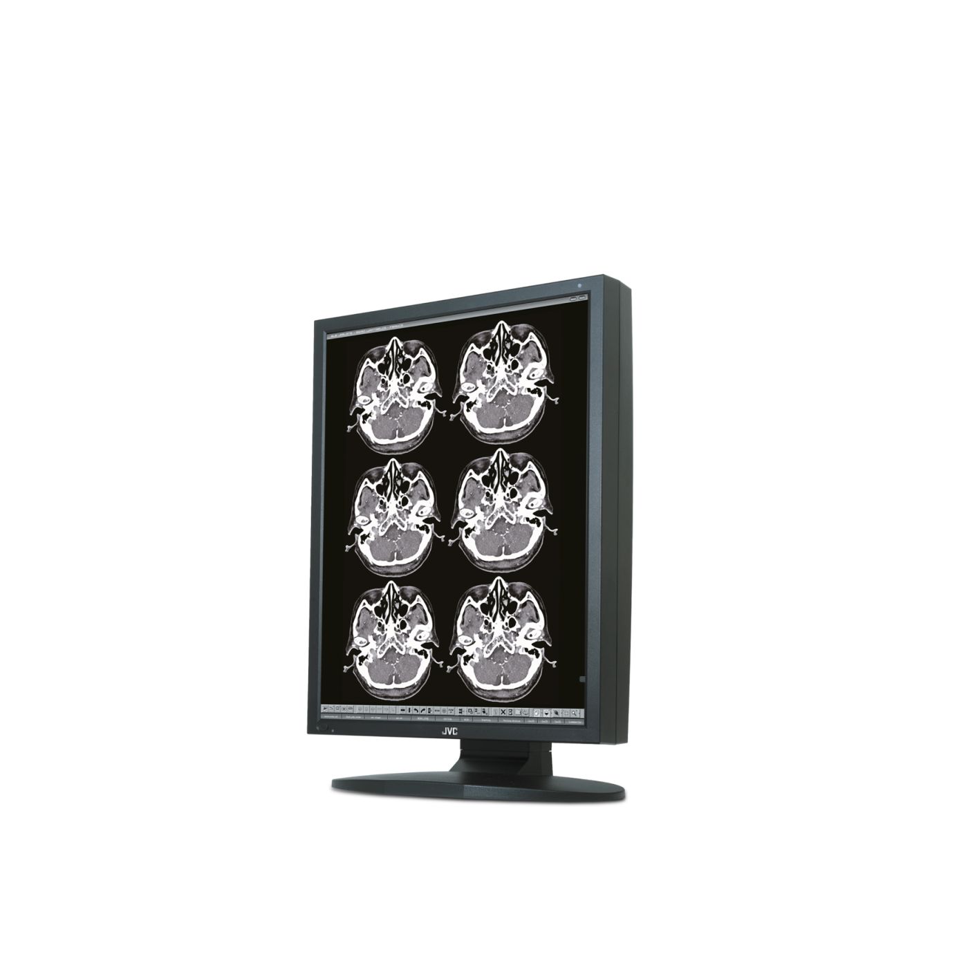 Медицинский монитор JVC MS25i2