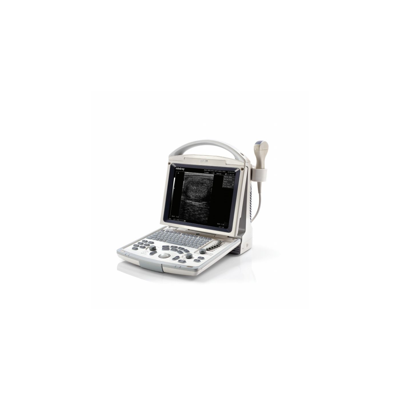 УЗ система Mindray DP-20