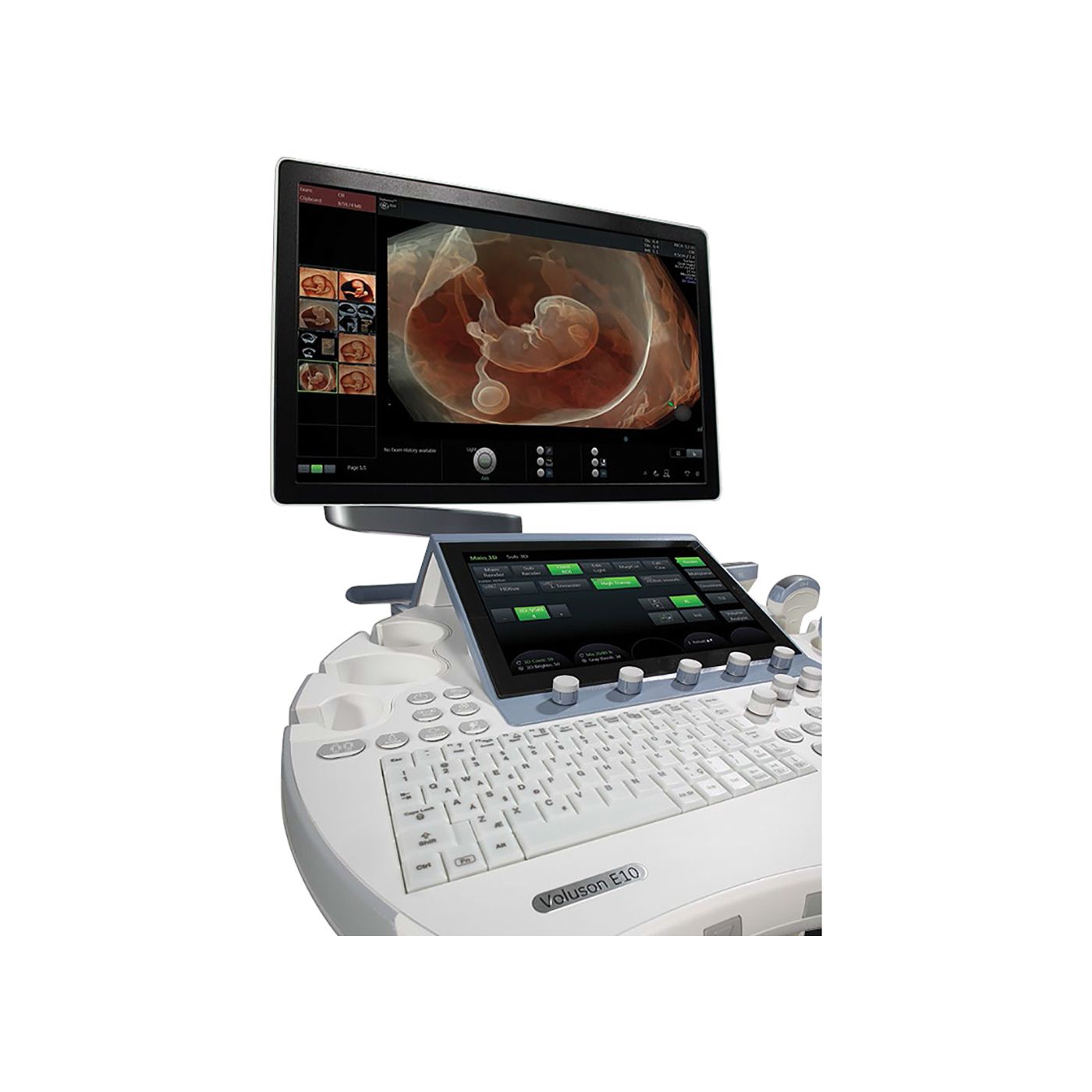 Ультразвуковая диагностическая система GE Healthcare Voluson E10