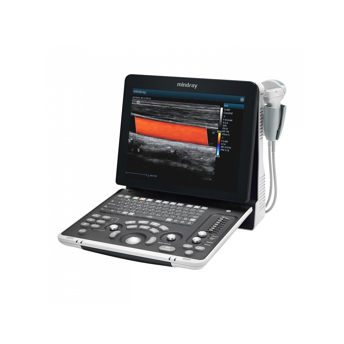 УЗИ сканер Mindray Z60