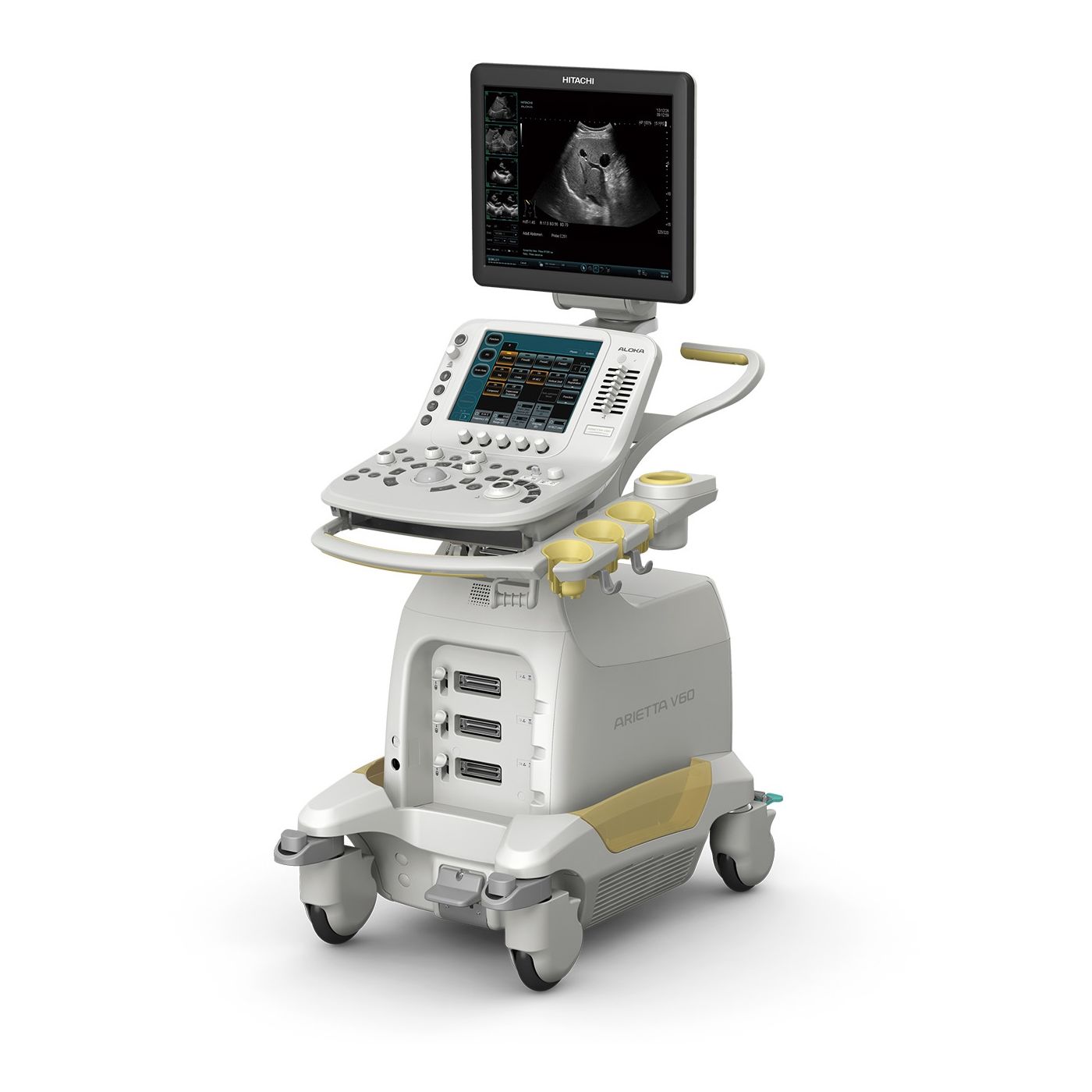 Ультразвуковой сканер Hitachi Arietta V60