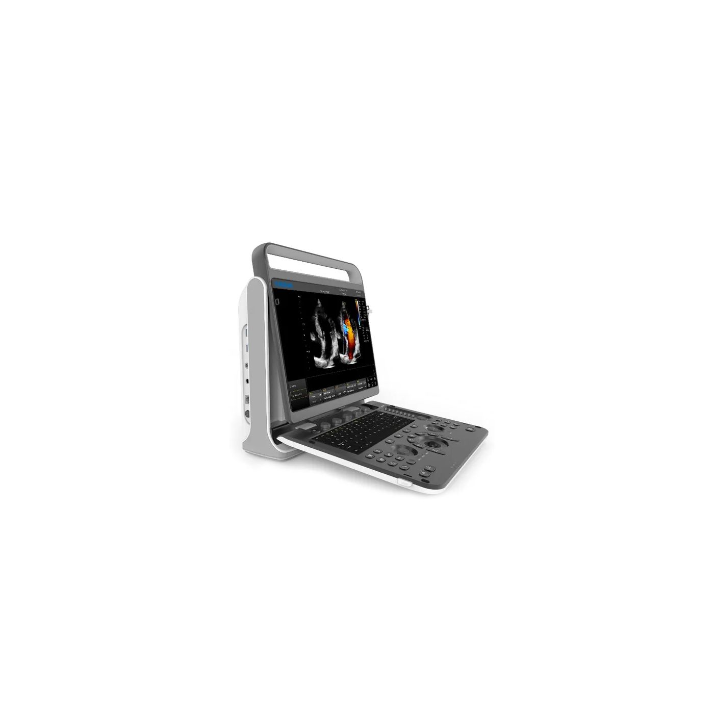 Портативный УЗИ аппарат Chison SonoTouch 60 Pro