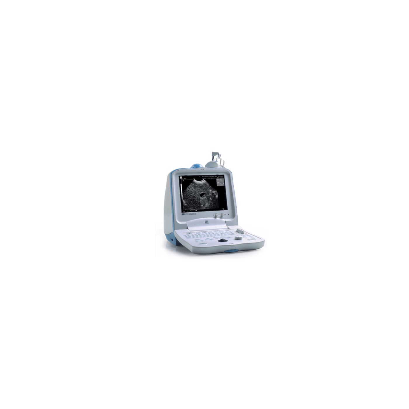 УЗИ аппарат Mindray DP 3300