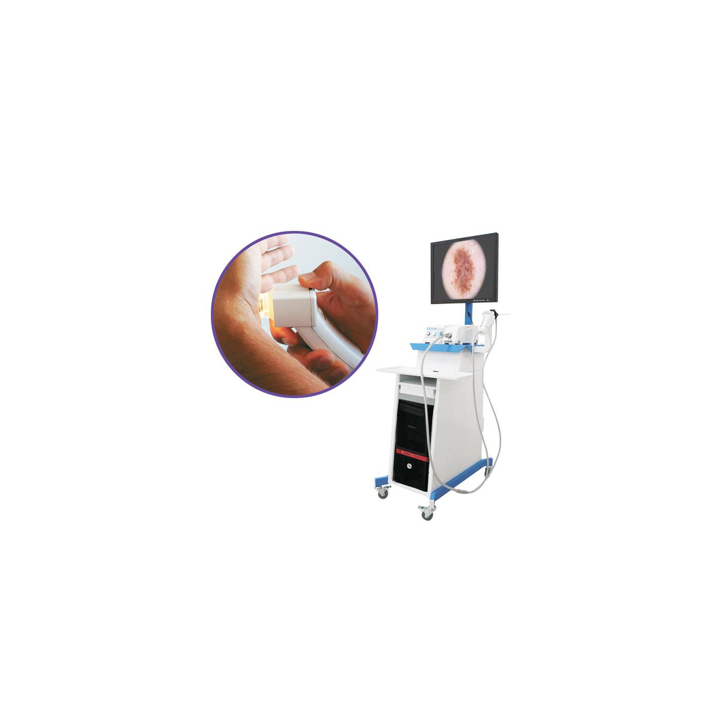 Видеодерматоскоп Medonica Dr. Camscope DCS-105 Pro