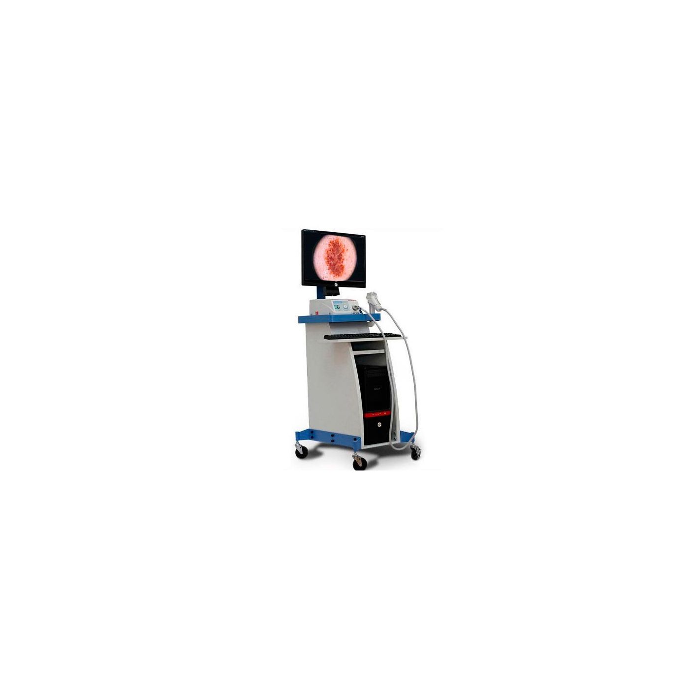 Видеодерматоскоп Medonica Dr. Camscope DCS-105 Pro