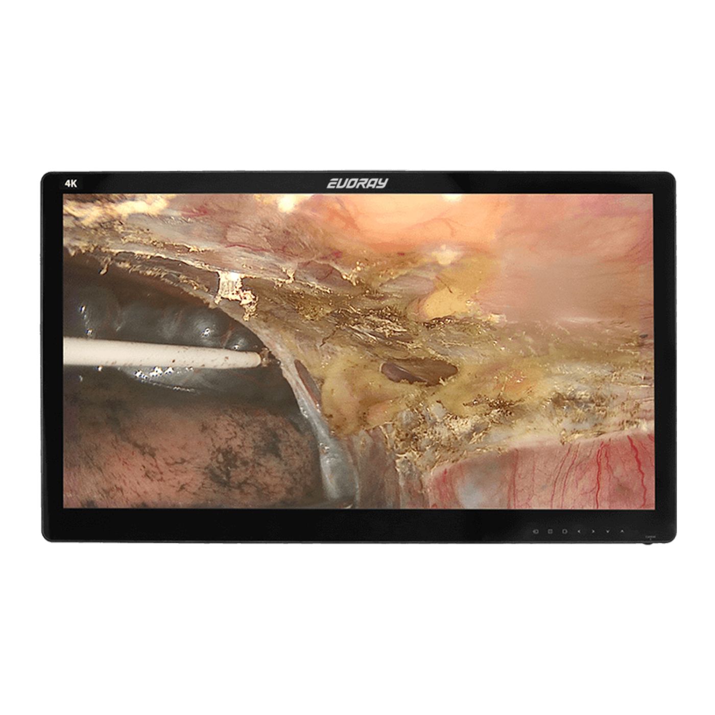 Монитор 32" 4K эндоскопический-хирургический  EVORAY S3281P
