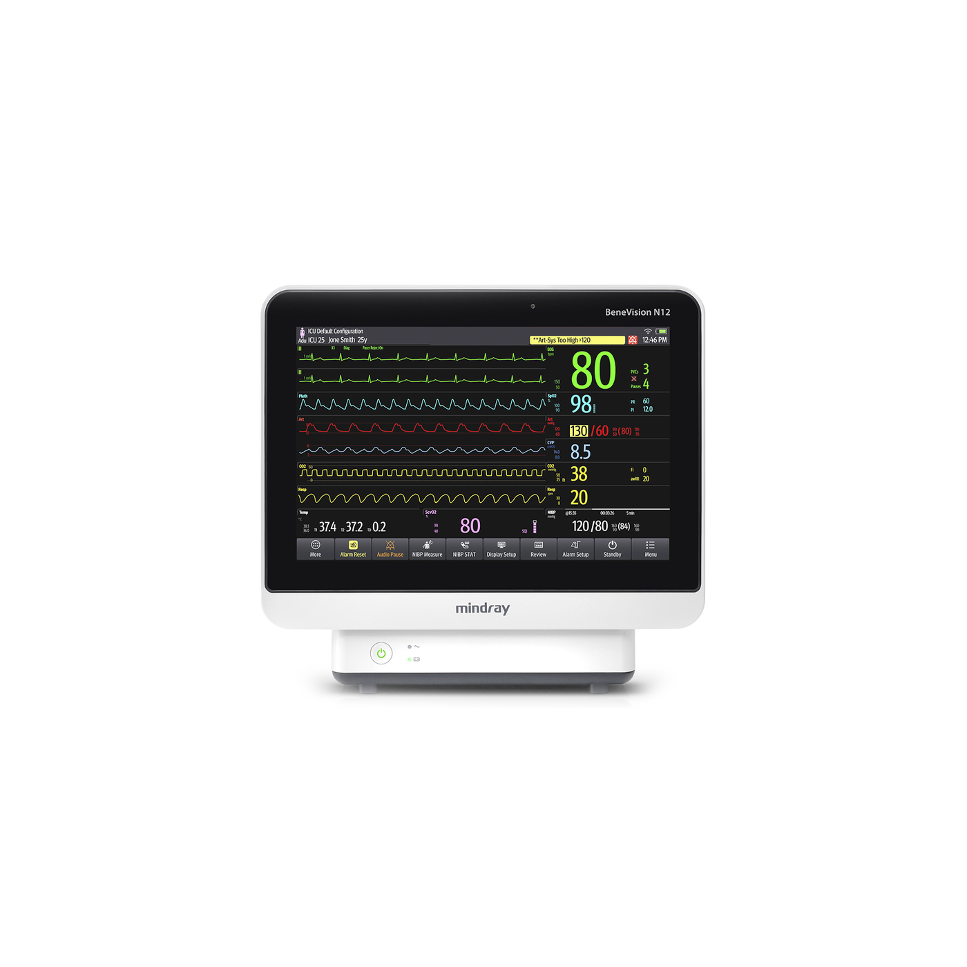 Монитор пациента Mindray BeneVision N12