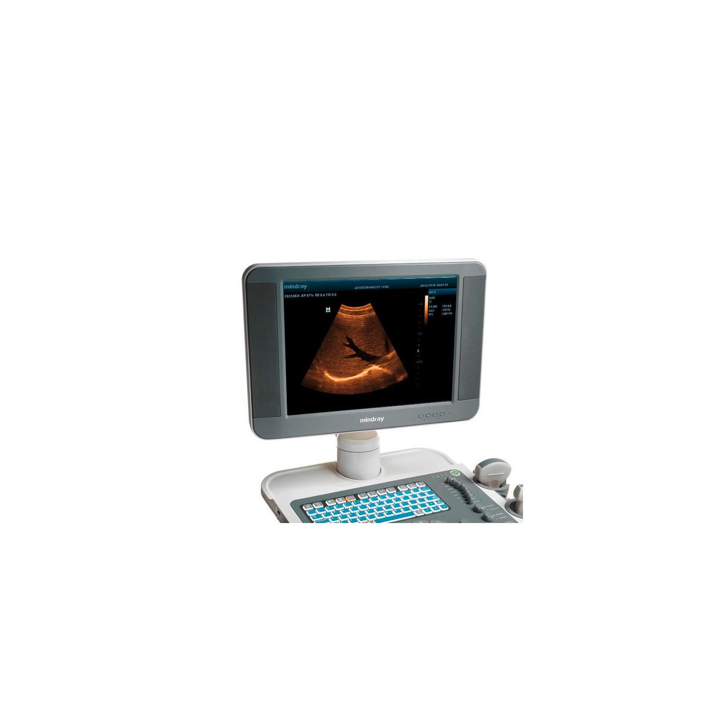 УЗИ аппарат Mindray DP-5