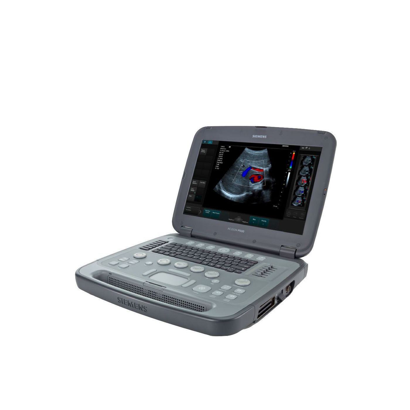 Ультразвуковая система Siemens Acuson P500