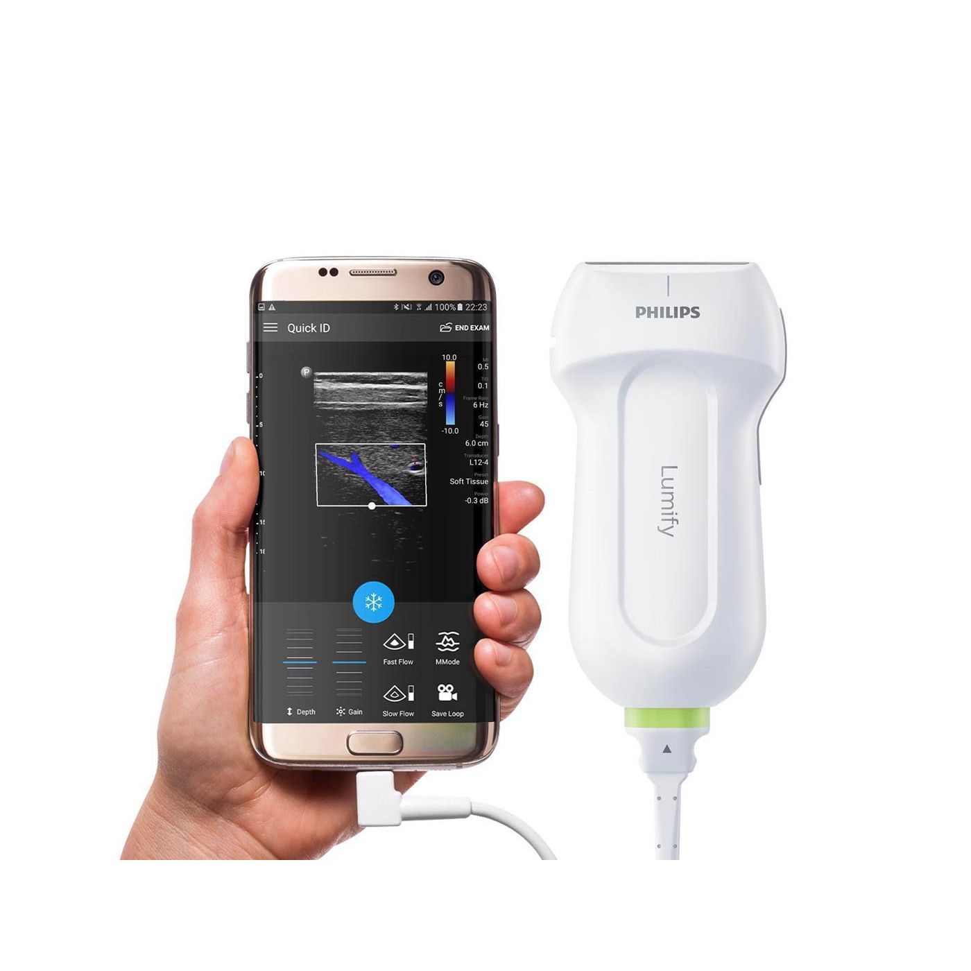 Мобильная ультразвуковая система Philips Lumify