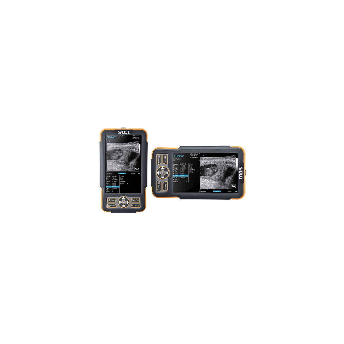 Ветеринарный УЗИ сканер SIUI CTS-800