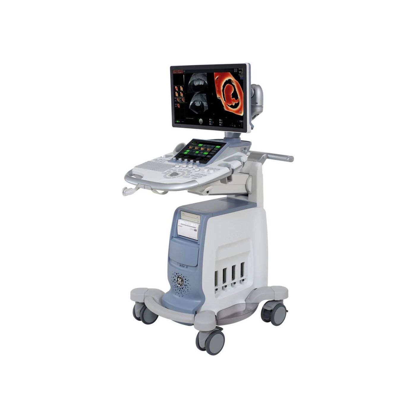 Ультразвуковая диагностическая система GE Healthcare Voluson S10