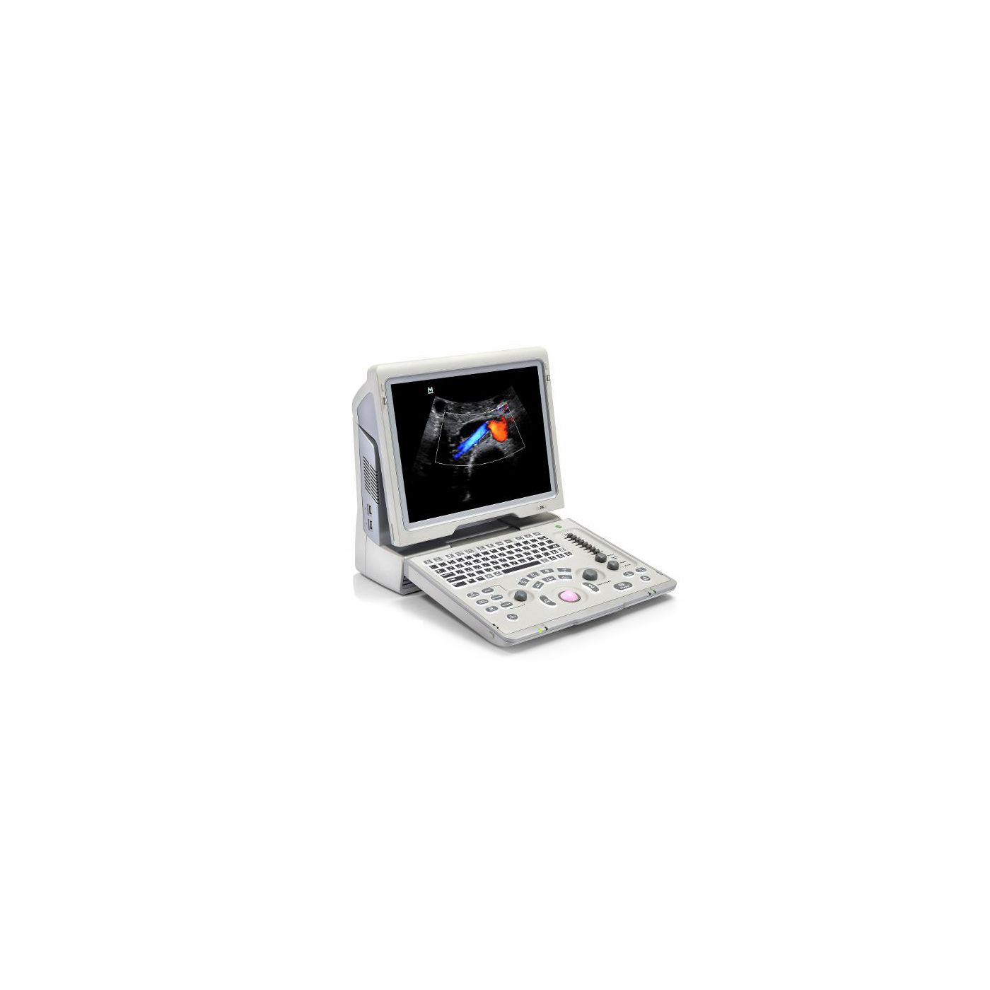 УЗИ аппарат Mindray Z6